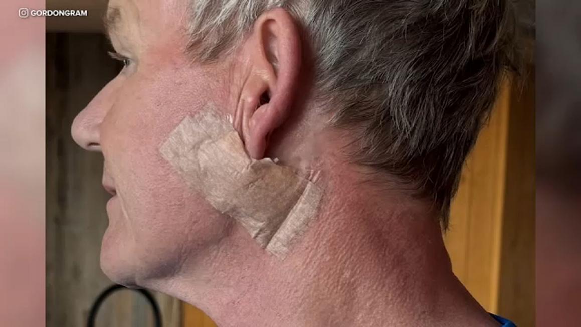 17697676 083025 kabc gordon ramsay cancer tn img