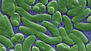 Người thứ năm tại Louisiana tử vong vì vi khuẩn ăn thịt khi số ca nhiễm tăng 9 Người thứ năm tại Louisiana tử vong vì vi khuẩn ăn thịt khi số ca nhiễm tăng