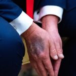 Tổng Thống Trump bác bỏ tin đồn sức khỏe, từng nghi ngờ đối thủ