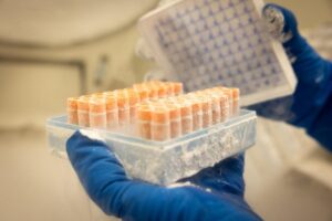 Nghiên cứu mới làm sáng tỏ vai trò của hệ miễn dịch trong bệnh ALS 11 Nghiên cứu mới làm sáng tỏ vai trò của hệ miễn dịch trong bệnh ALS