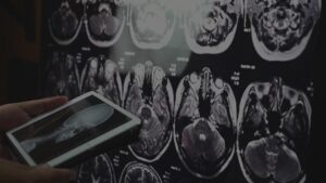 Muốn Làm Chậm Quá Trình Lão Hóa Của Não Bộ? Nghiên Cứu Mới Cho Thấy Thay Đổi Lối Sống Có Thể Là Chìa Khóa Giữ Cho Não Trẻ Trung 16 Muốn Làm Chậm Quá Trình Lão Hóa Của Não Bộ? Nghiên Cứu Mới Cho Thấy Thay Đổi Lối Sống Có Thể Là Chìa Khóa Giữ Cho Não Trẻ Trung