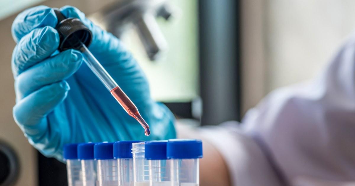 Dấu hiệu mất cân bằng hormone và khi nào cần xét nghiệm 1 251114 test tubes stock ch 1024 55606e