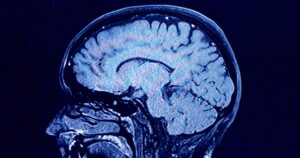 Bộ não người có 5 giai đoạn riêng biệt