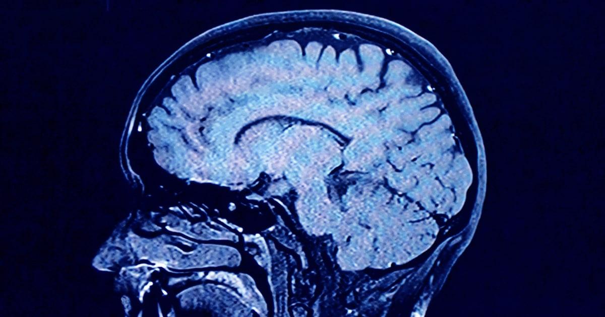 251124 brain mri lr e7795a