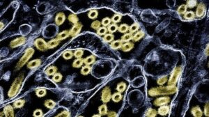 Ca Nghi Nhiễm Cúm Gia Cầm Lần Đầu Ở Mỹ Sau 9 Tháng 15 Ca Nghi Nhiễm Cúm Gia Cầm Lần Đầu Ở Mỹ Sau 9 Tháng