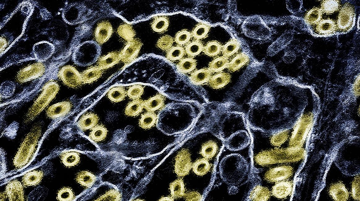 Ca Nghi Nhiễm Cúm Gia Cầm Lần Đầu Ở Mỹ Sau 9 Tháng 1 bird gty er