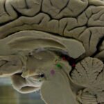 Não người trưởng thành hoàn toàn ở tuổi 32, theo nghiên cứu