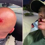 DHS: Lời lẽ ‘thánh địa’ khiến bạo lực tăng 1,150% nhắm vào nhân viên ICE