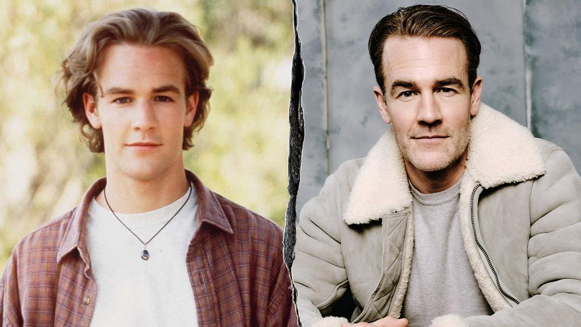 Ngôi sao 'Dawson's Creek' bán kỷ vật để chi trả chi phí chữa ung thư 1 james van der beek dawsons creek