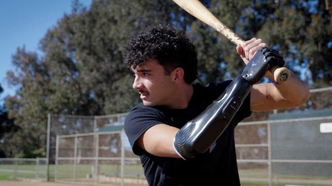 1 bionic hand brings baseball star back to the field