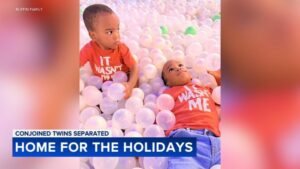 Cặp song sinh dính liền mừng cột mốc Giáng Sinh