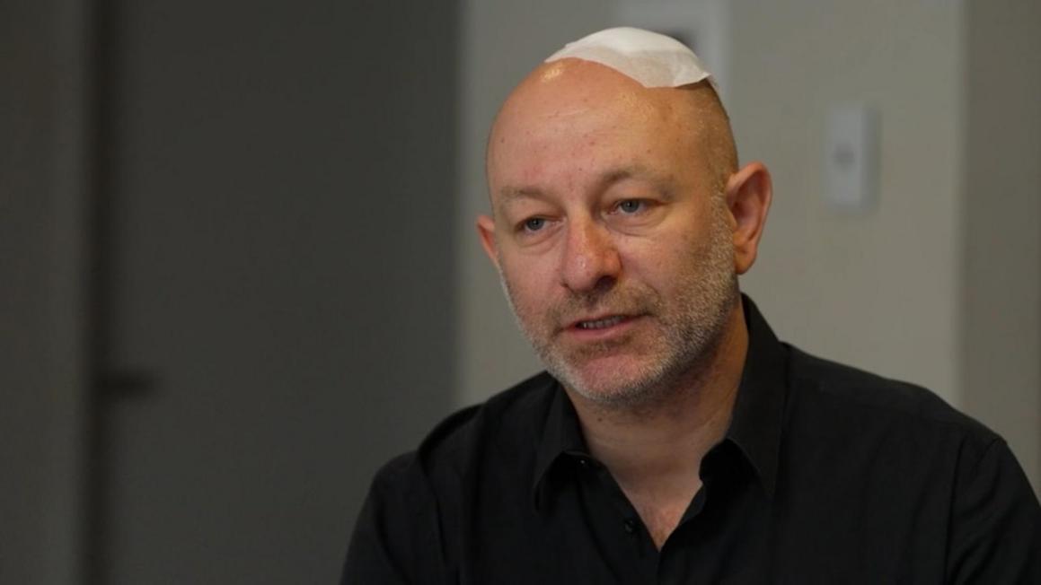 Người sống sót sau vụ xả súng Bondi Beach kể lại 1