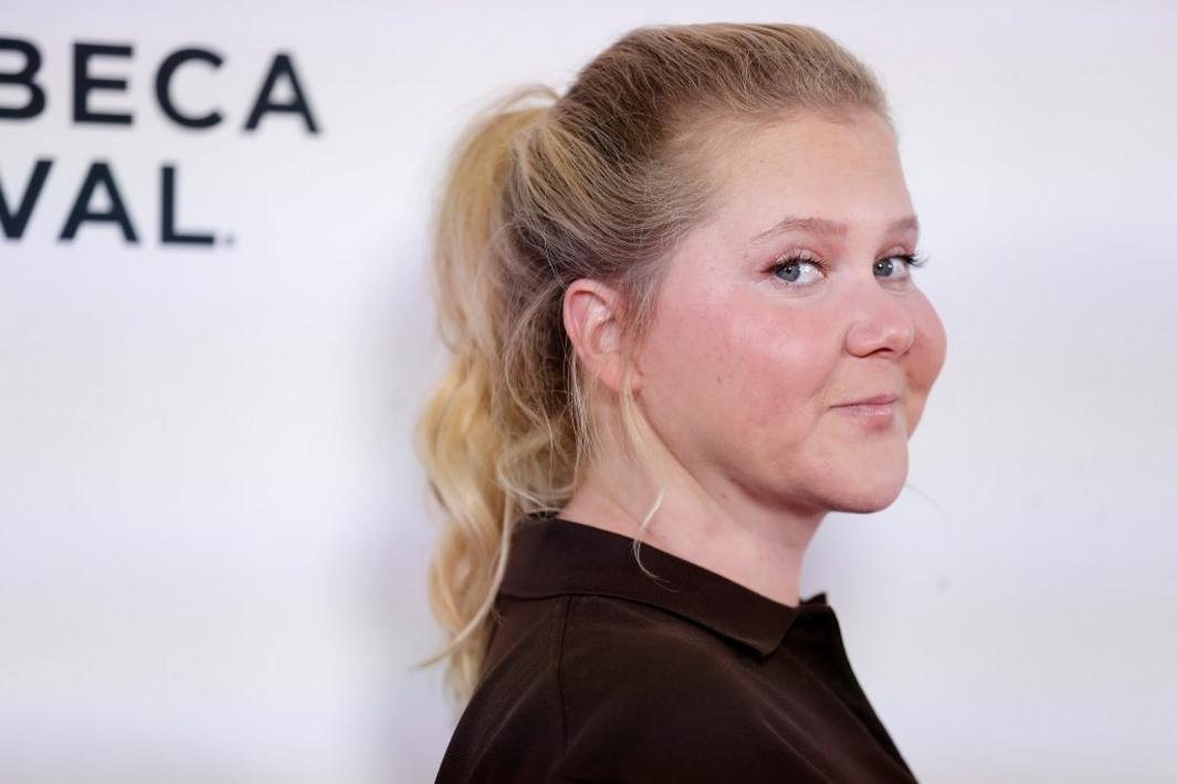 Amy Schumer Bỏ Nhẫn Cưới Trong Ảnh Giảm Cân Mới 1 AmySchumer