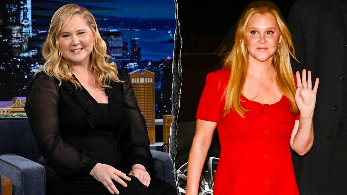 amy schumer before after