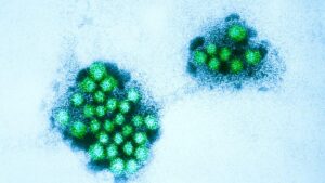 Dịch bệnh Norovirus gia tăng tại California 17 Dịch bệnh Norovirus gia tăng tại California