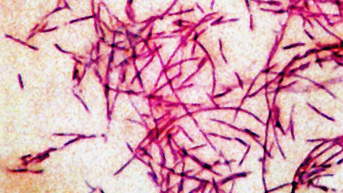 14 Ca Bệnh Legionnaires Tại Florida, Có Thể Liên Quan Đến Phòng Gym 1 legionnaires disease stock gty jef