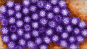 Gia tăng các ca nhiễm Norovirus tại Vùng Vịnh