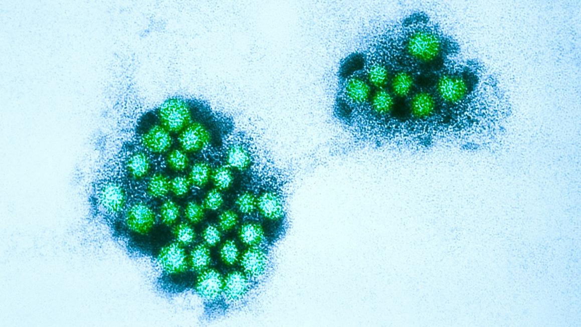 Dịch bệnh Norovirus gia tăng tại Los Angeles 1 norovirus gty er