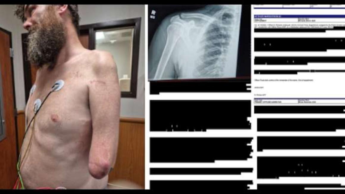 Người đàn ông khuyết tật ở Conroe tố cáo bị cảnh sát hành hung 1