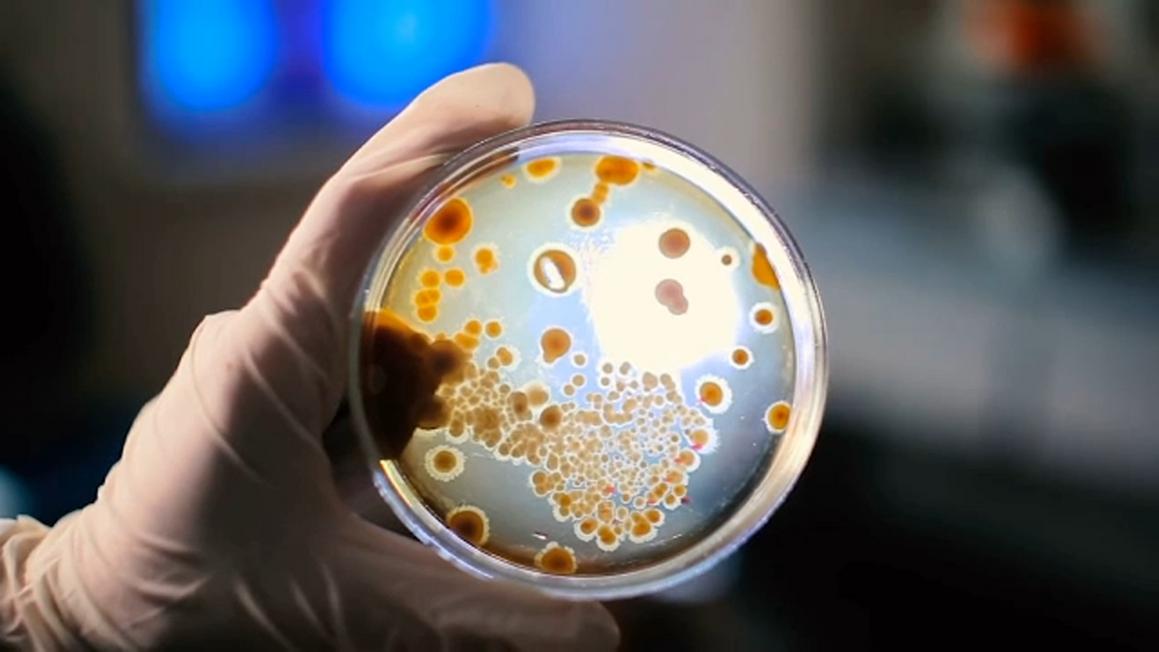 California Ghi Nhận Gia Tăng Trường Hợp Norovirus, Cách Lây Lan Bất Ngờ Qua Gia Đình 1 18493933 012826 kabc laundry germs