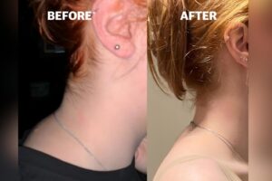 Moench Method Bodywork: Nơi Hy Vọng Gặp Gỡ Chữa Lành 2 Moench Method Bodywork: Nơi Hy Vọng Gặp Gỡ Chữa Lành