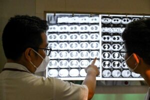 Những điều cần biết về bệnh lao tại Vùng Vịnh sau vụ bùng phát tại trường trung học