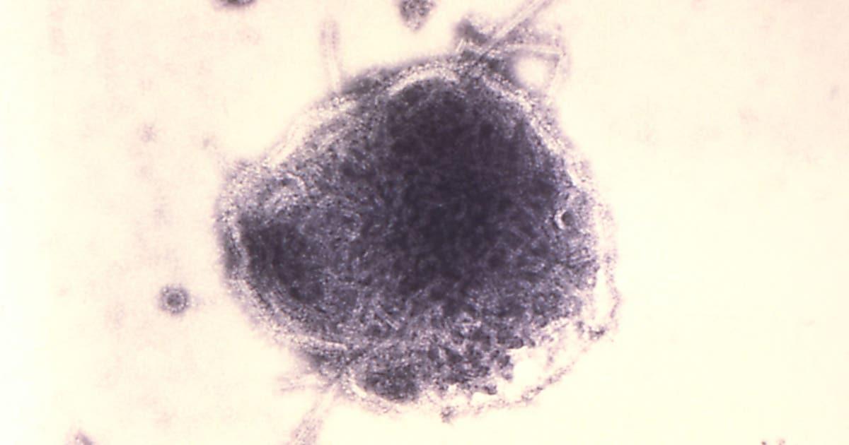 gettyimages 937382850 1 scaled 1