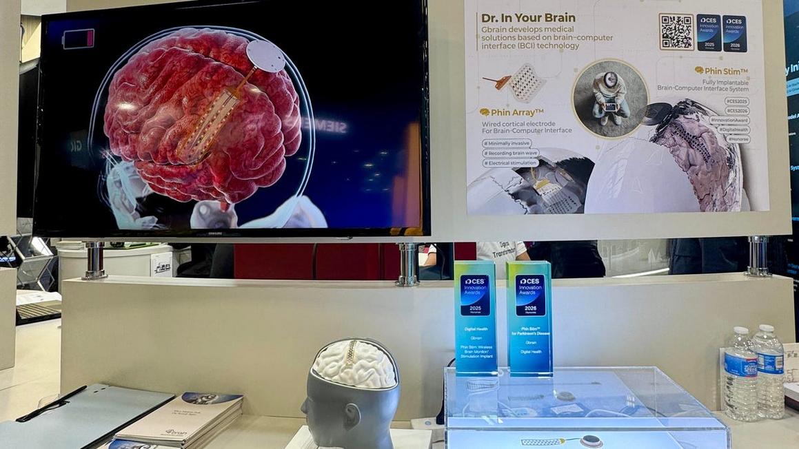 Thiết bị Phin Stim của GBRAIN: Kỷ nguyên mới trong điều trị thần kinh bằng cấy ghép