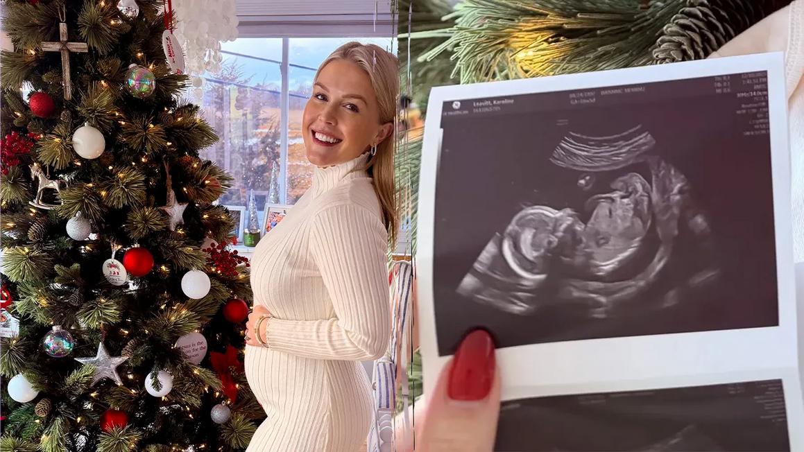 karoline leavitt sonogram photo split