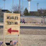 Ít nhất 171 ca sởi được xác nhận tại 9 tiểu bang ở Mỹ