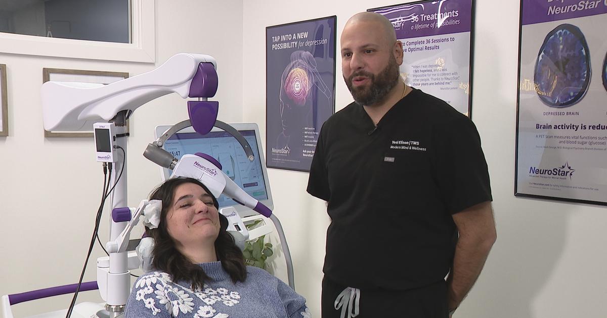 Phương pháp điều trị trầm cảm mới bằng kích thích từ trường 1 tms machine