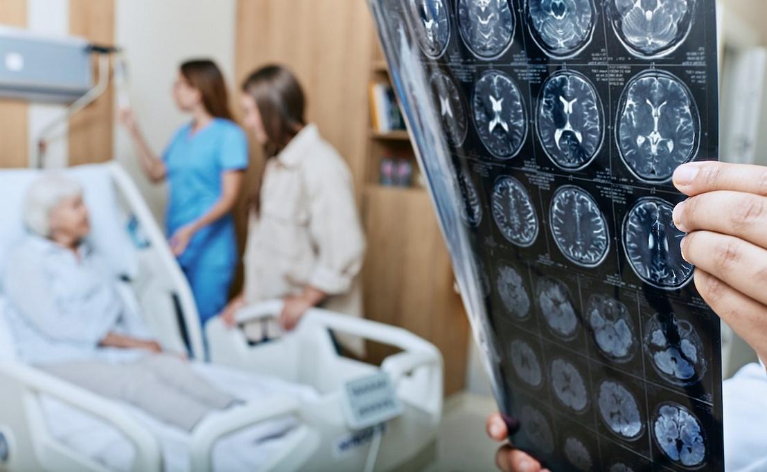 Thiết bị AI hỗ trợ người đột quỵ lấy lại giọng nói 1 MRI brain scans