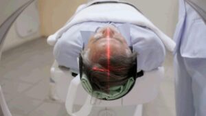 Một tình trạng não ít người biết có thể làm tăng nguy cơ sa sút trí tuệ gấp bốn lần ở người lớn tuổi, theo nghiên cứu mới