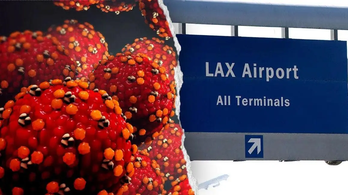 Du khách nhiễm sởi có thể đã lây lan virus tại Sân bay Quốc tế Los Angeles và khách sạn gần đó