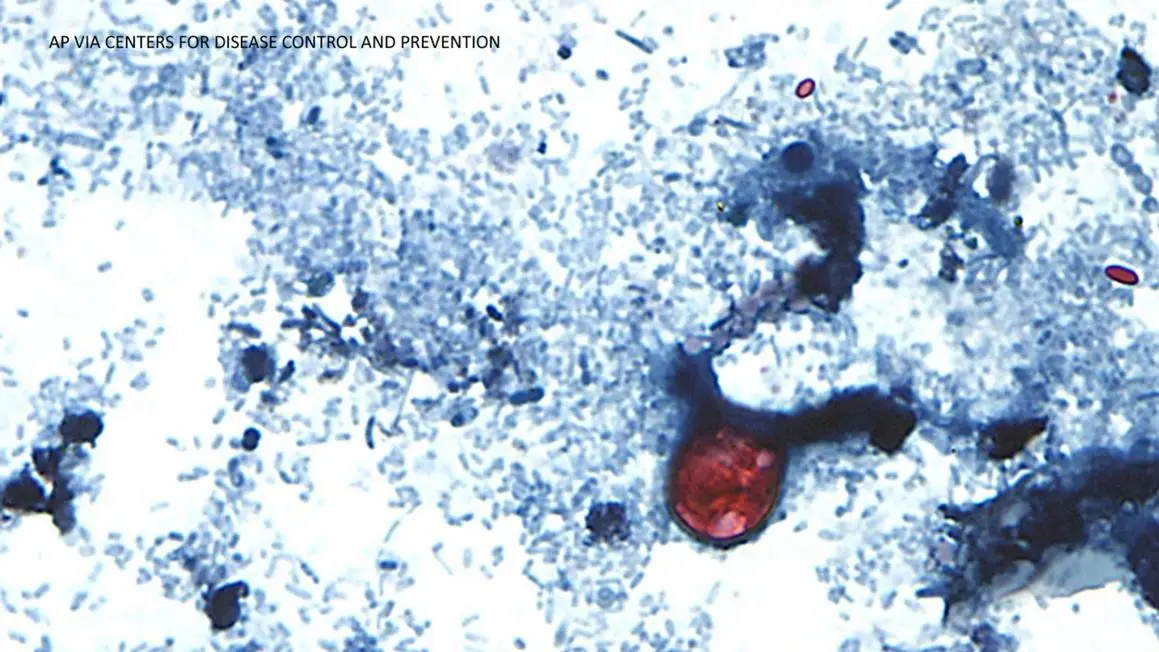 Dịch bệnh Cyclosporiasis lan rộng khắp Hoa Kỳ, California có số ca nhiễm từ 1-10