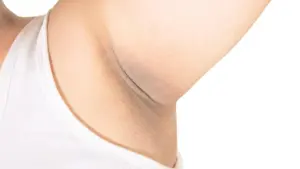 Khử Mùi Vùng Da Dưới Cánh Tay Có Thể Che Phủ Các Vết Thâm – Nhưng Có An Toàn Không?