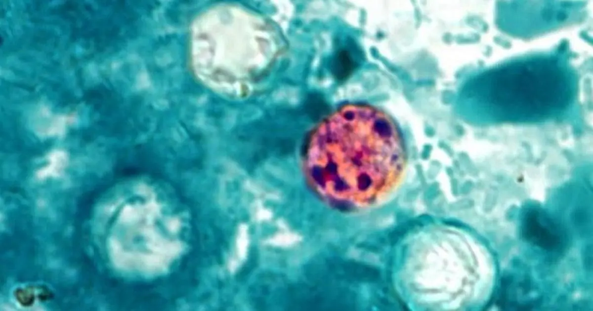 Tổ chức Y tế Hoa Kỳ điều tra dịch bệnh Cyclosporiasis tại California