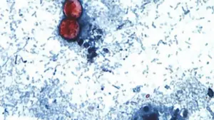 Taco Bell Tạm Thời Gỡ Bỏ Một Số Nguyên Liệu Giữa Dịch Bệnh Cyclosporiasis