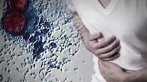 Cảnh Báo Về Dịch Bệnh Ký Sinh Trùng Cyclospora Khi Lây Lan Trên Toàn Hoa Kỳ