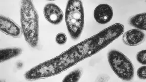 Số ca bệnh Legionnaires giảm ở New York, Bảo tàng Metropolitan có kết quả dương tính