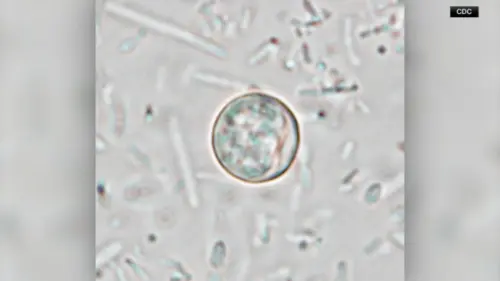Số ca Cyclosporiasis tại Hạt Harris là 54; 10 ca mới tại Houston, giới chức y tế cho hay