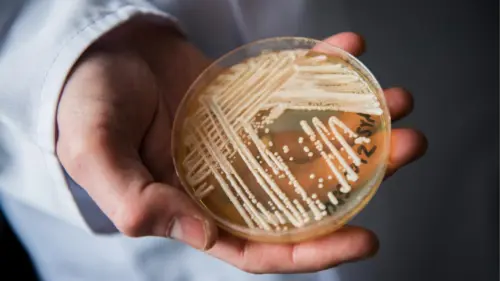 Nhiều Tiểu Bang Hoa Kỳ Phát Hiện Nấm Candida Auris Gây Bệnh Nguy Hiểm