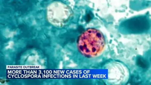 Hơn 3.100 ca nhiễm Cyclosporiasis được báo cáo trong tuần qua, theo giới chức y tế