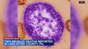 Hai người tử vong vì bệnh sởi tại Pennsylvania, giới chức y tế cho biết