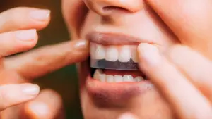 Các loại miếng dán làm trắng răng hiệu quả nhất năm 2026