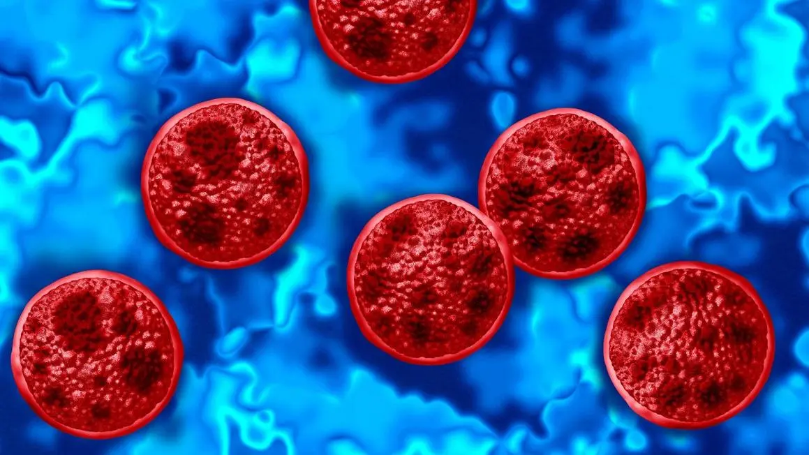 Michigan ghi nhận hai ca tử vong trong vụ bùng phát Cyclosporiasis