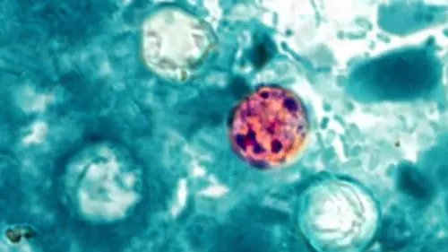 Vương quốc Anh ghi nhận số ca nhiễm Cyclospora gia tăng đột biến, liên quan đến du lịch Mexico