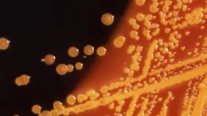 Quan chức y tế Hoa Kỳ điều tra vụ ngộ độc E. coli và Salmonella liên quan đến giá đỗ