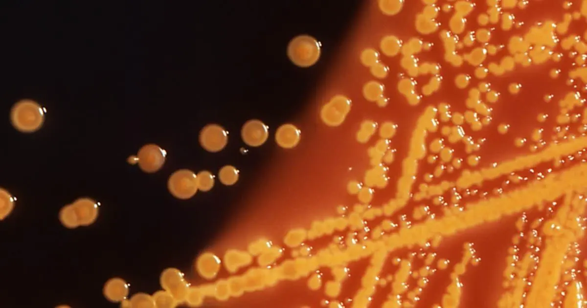 Quan chức y tế Hoa Kỳ điều tra vụ ngộ độc E. coli và Salmonella liên quan đến giá đỗ