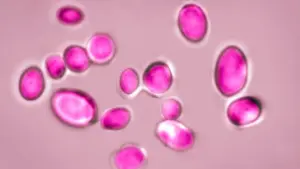 Texas dẫn đầu Hoa Kỳ về số ca nhiễm nấm Candida auris nguy hiểm